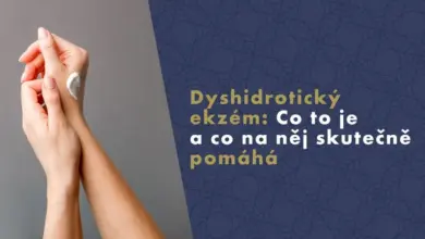 Ruční aplikace krému na kůži při léčbě ekzemu.