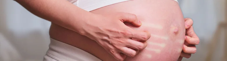 Těhotná žena drží ruce na svém břiše s jasnou kůží.