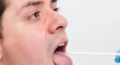 Muž s otevřenou ústní dutinou při odběru vzorku z jazyka.