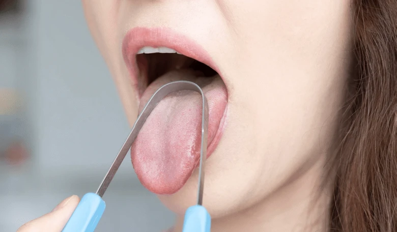 Osobní vyšetření jazyka nástrojem pro diagnostiku orální kandidózy