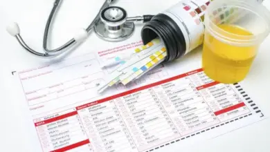 Kontejner s testovými proužky na moč, krevní tlakový měřič a vzorek moči.