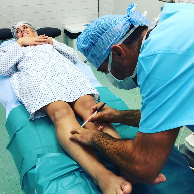 Lékař označuje koleni pacientky před zákrokem na žíly nebo otoky
