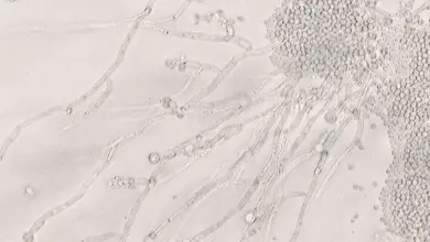 Oral candida fungus