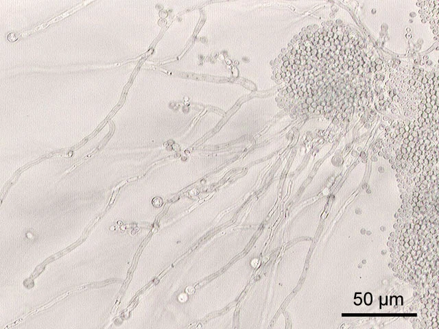Oral candida fungus