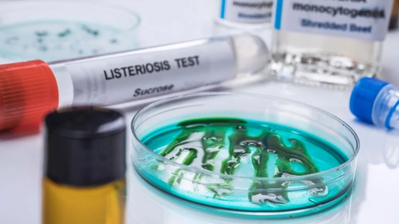 Laboratorní test listeriózy s kulturou bakterií v Petrijevě misku.